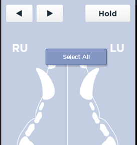 Tooth Areas 4
